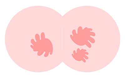 Diaper Rash 1-2-3: A Comprehensive Guide to Diaper Rash