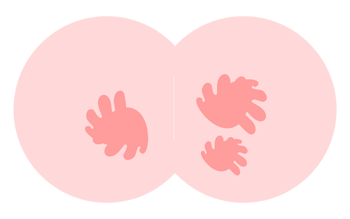 Diaper Rash 1-2-3: A Comprehensive Guide to Diaper Rash