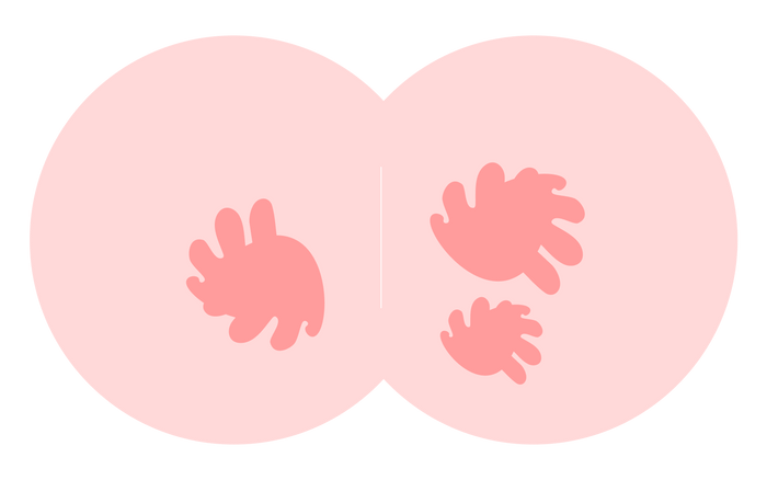 Diaper Rash 1-2-3: A Comprehensive Guide to Diaper Rash
